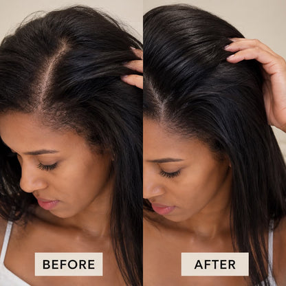 ROOTS &amp; RITUAL Hair Growth Serum